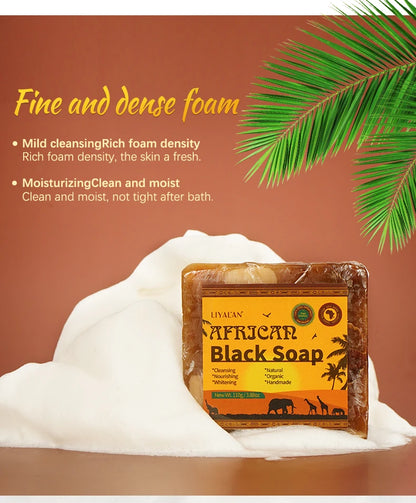 100g Natural African Black Soap With Organic Shea Butter Anti Rebelles Treatment Acne Moisturizing SkinCare Handmade Body Bath